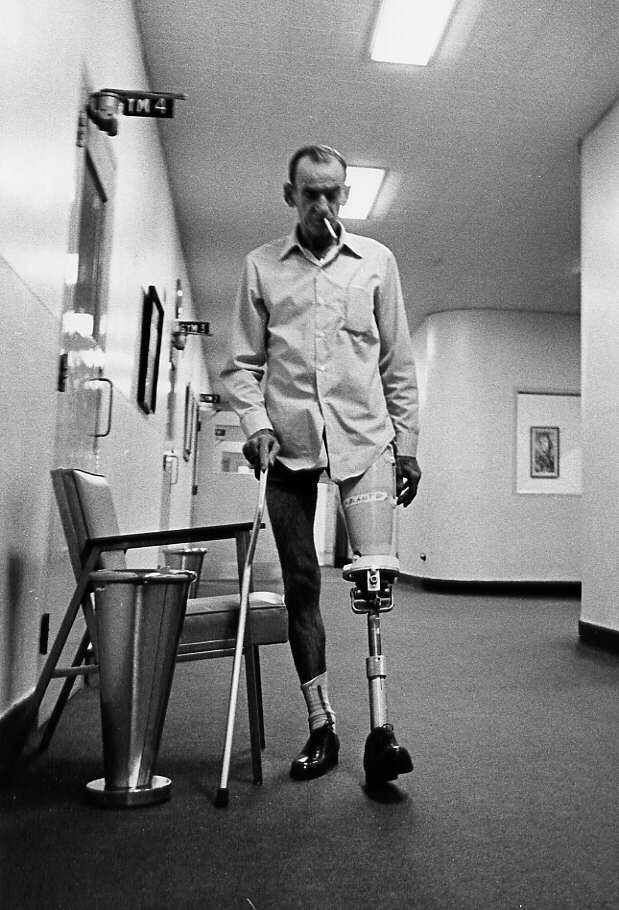 Un homme amputé essayant sa nouvelle prothèse